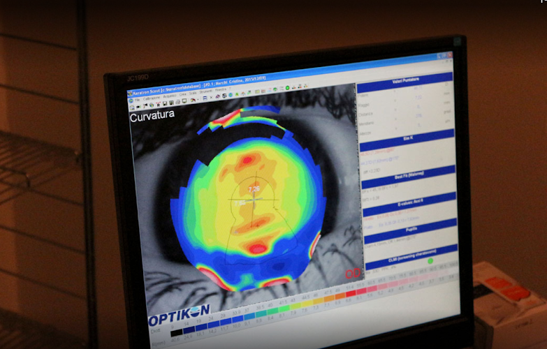 Optomedica Vittorio Veneto - Centro oculistico - Vittorio Veneto